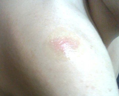 Пигментация Буфер обмена01.jpg