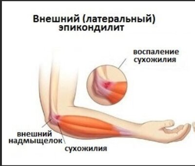 Скриншот 18-09-2023 114242.jpg
